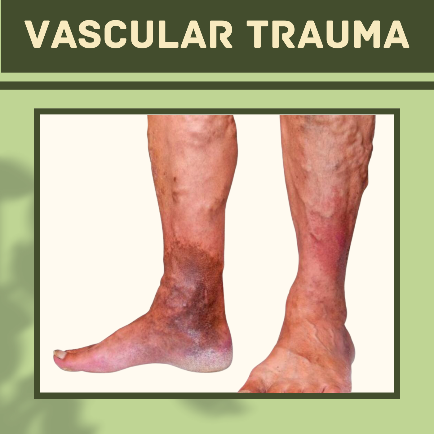 Vascular Trauma, Blood Vessel Injury, Muscles Trauma, Mehsana, Nanded, Chapra, Surat, India. episode artwork