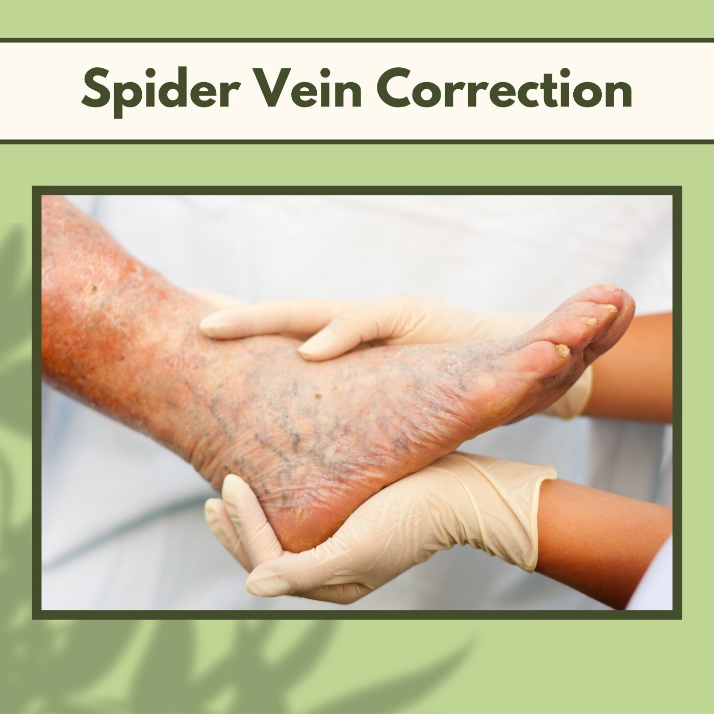 Spider Vein Correction, Vein Disorders, Laser Therapy, Palanpur, Latur, Nanded, Surat, India. episode artwork