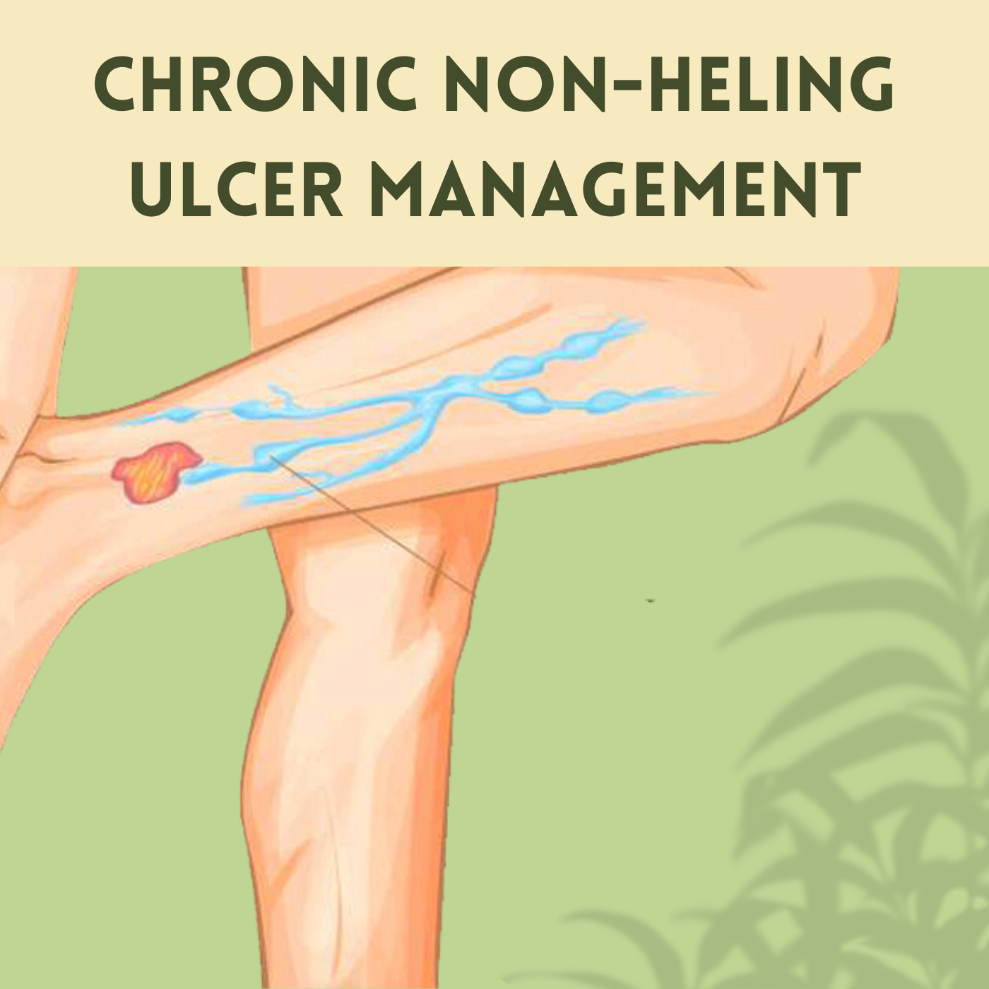 Chronic Non-Heling Ulcer Management, Leg Ulcer, Laser, Sclerotherapy, Junagad, Solapur, Ratlam, Surat, Gujarat. episode artwork