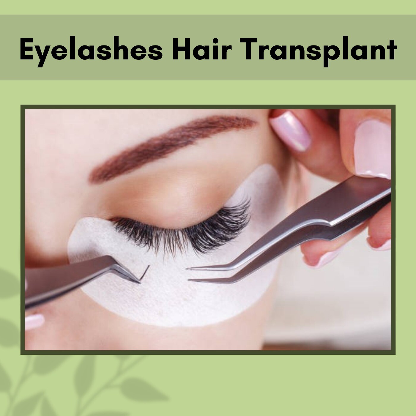 Eyelashes Hair Transplant, FUE Technique, Lash Implantation, Mumbai, Gandhidham, Bhopal, Surat, Gujarat. episode artwork