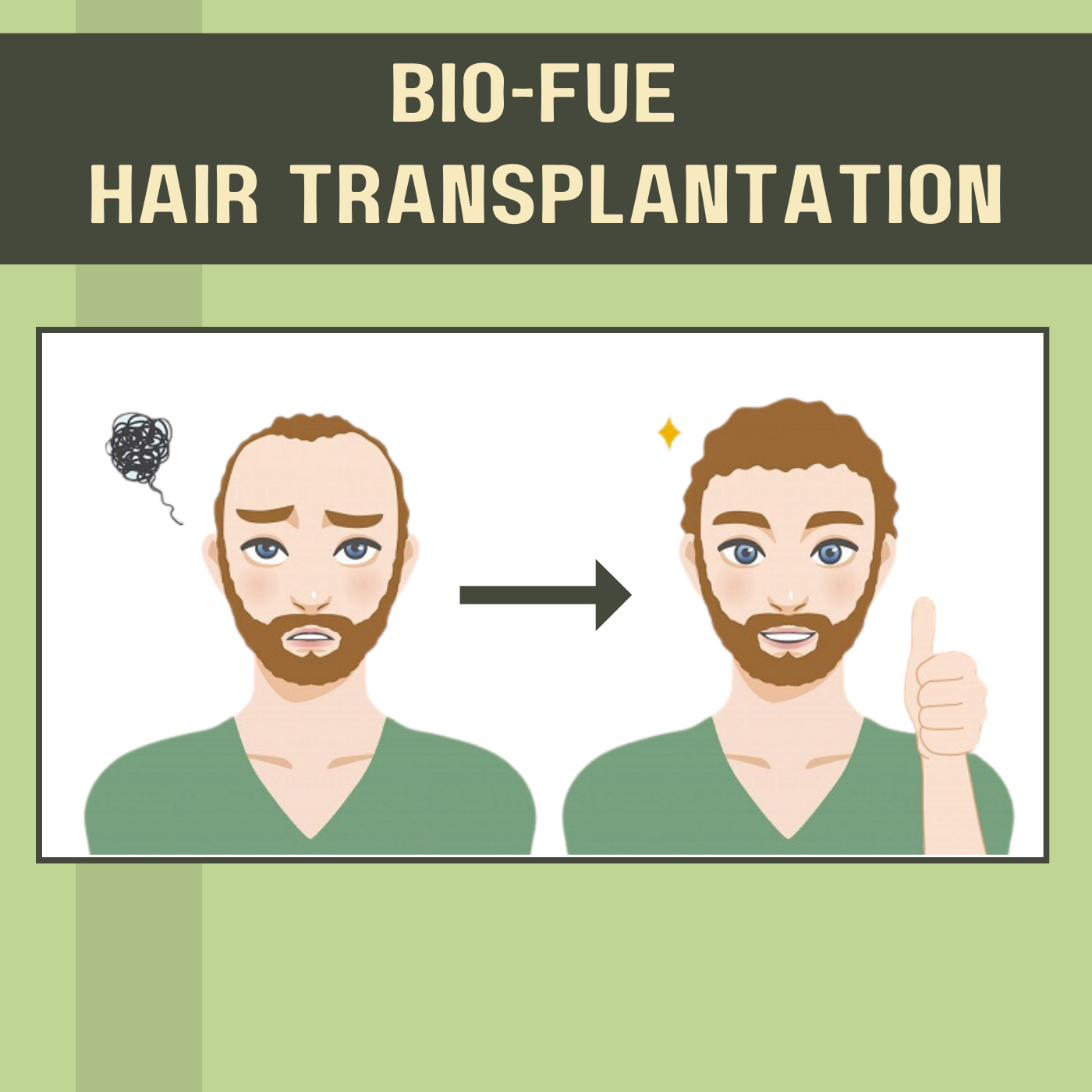 BIO-FUE Hair Transplantation, Graft Extraction, PRP, Jalna, Jamnagar, Shivpuri, Surat, Gujarat. episode artwork