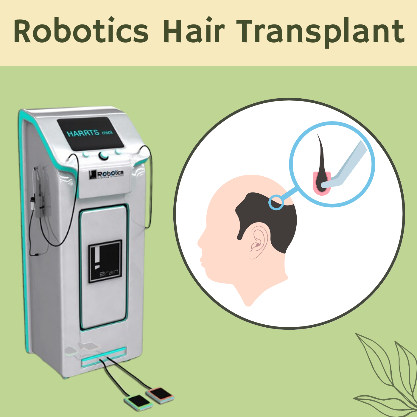 Robotics Hair Transplant, ARTAS Hair Transplant, High-Tech Hair Restoration, Akola, Porbander, Gwalior, Surat, Gujarat. episode artwork