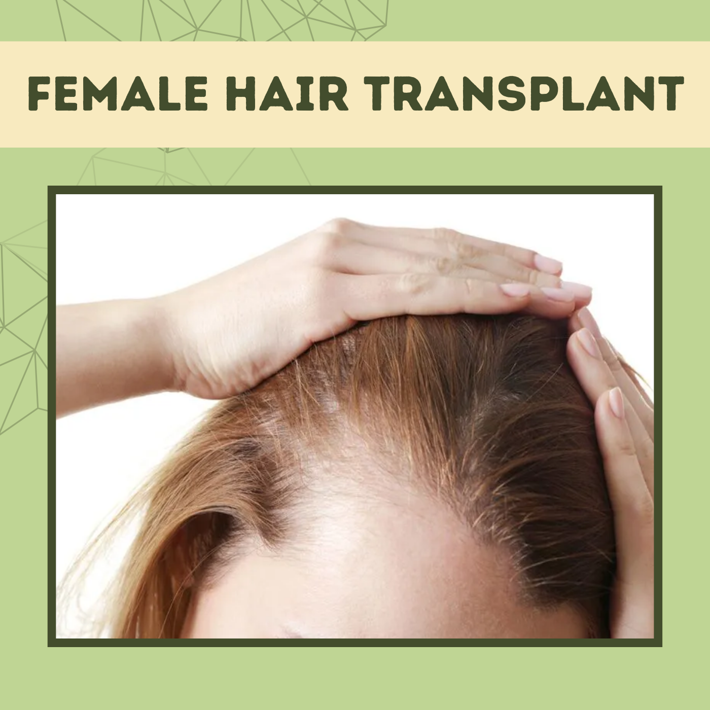 Female Hair Transplant, Hair Restoration, FUT Treatment, Nashik, Prayagraj, Bhilwara, Surat, India.
