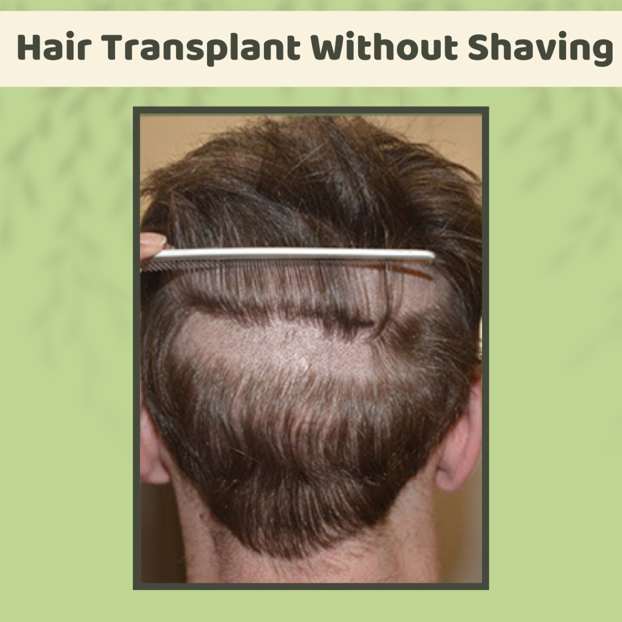 Hair Transplant Without Shaving, No-Shave Grafting Technique, FUE & FUT Treatment, Kolhapur, Ambikapur, Mumbai, Surat, India. episode artwork