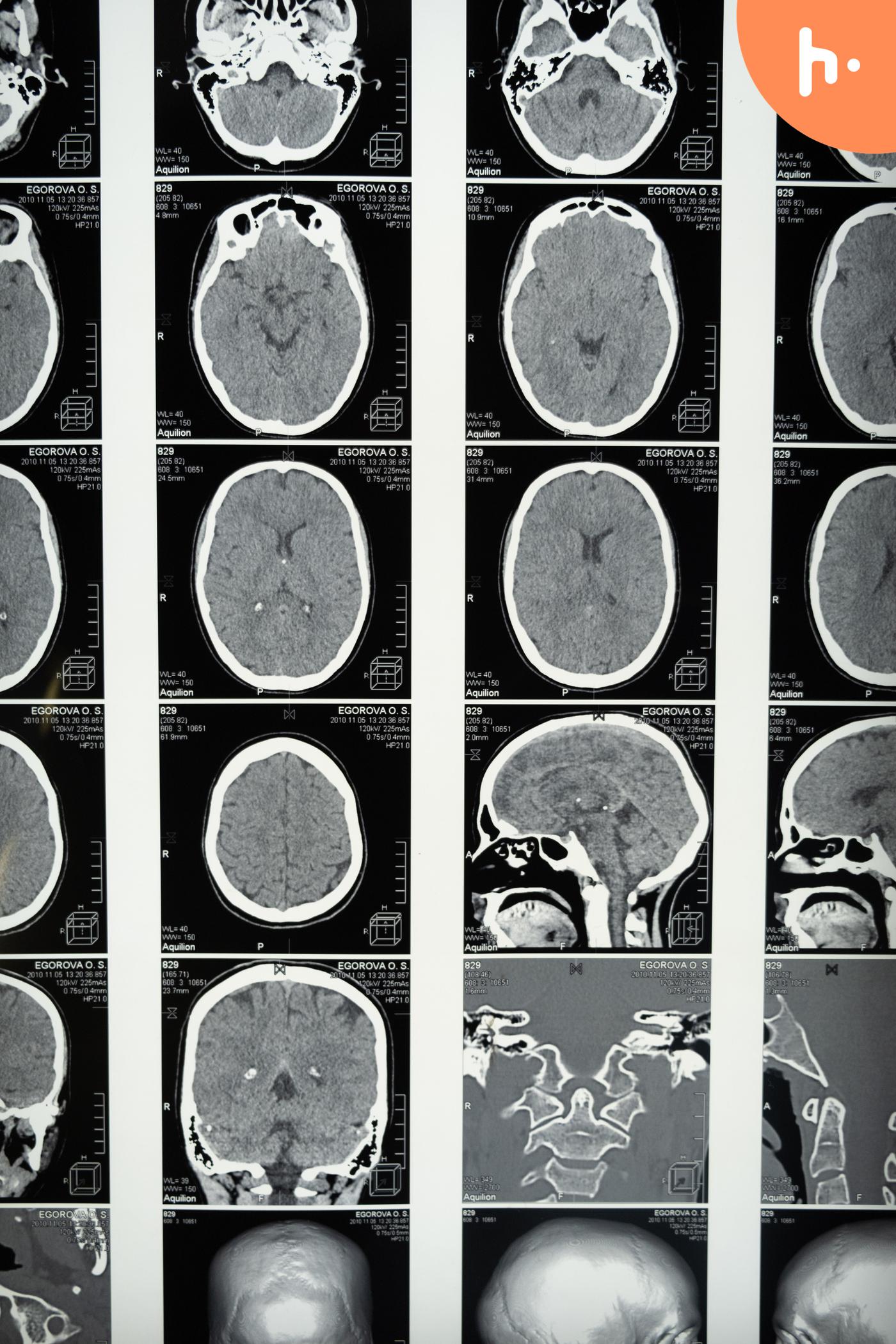 Podcast: Learn about neurosurgery from experts podcast artwork
