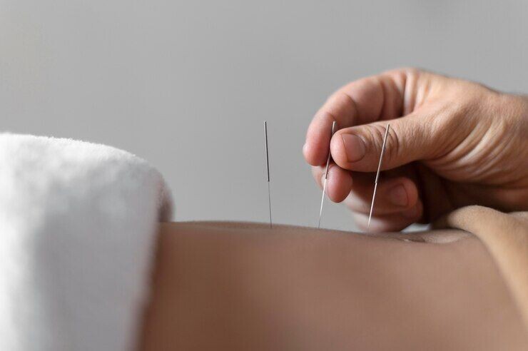 Experience Deep Relaxation with Our Acupuncture Sessions episode artwork