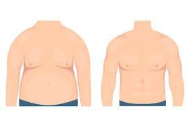 Unveiling Confidence: The gynecomastia surgery special podcast episode artwork