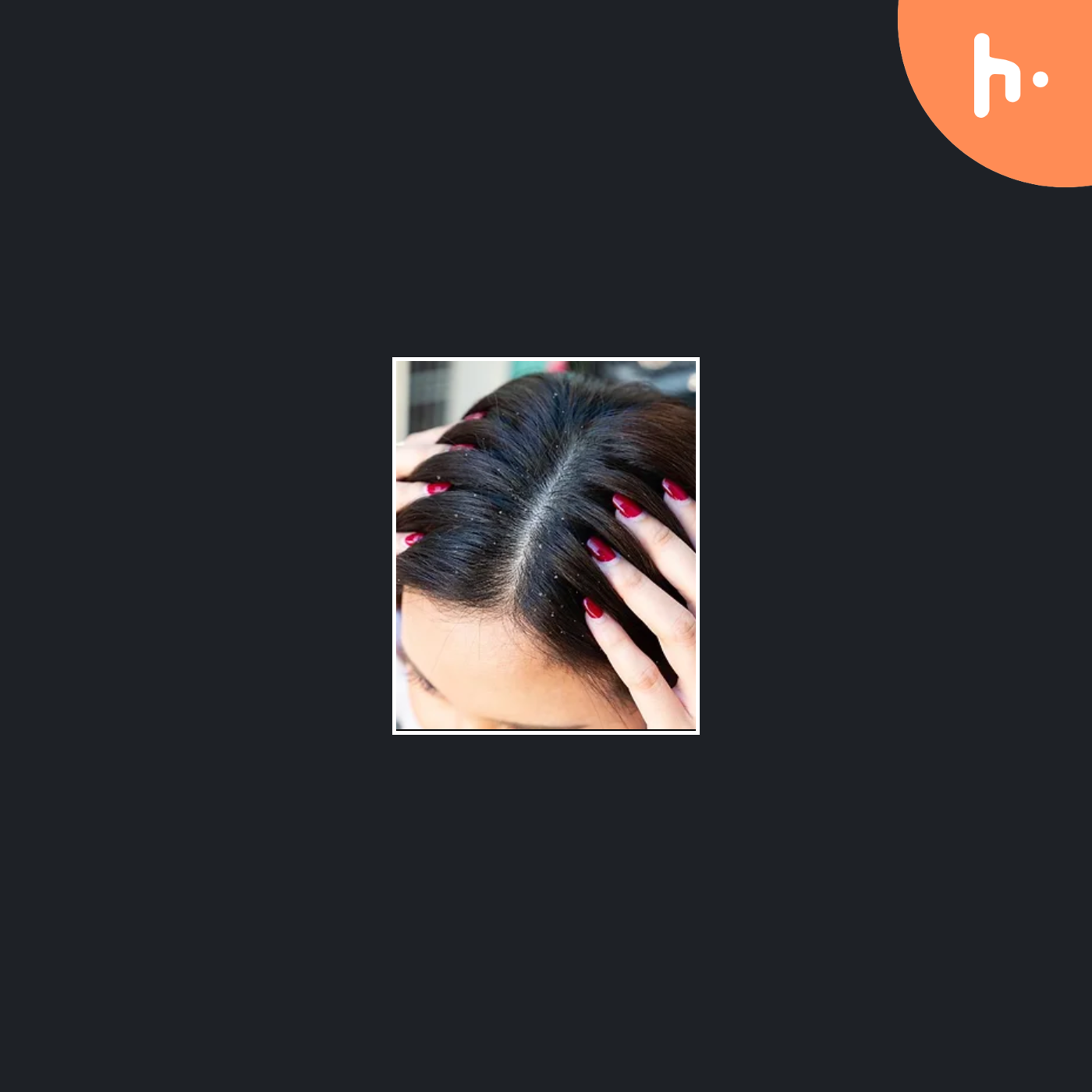 Dandruff Treatment Hair Spa in Chennai podcast artwork