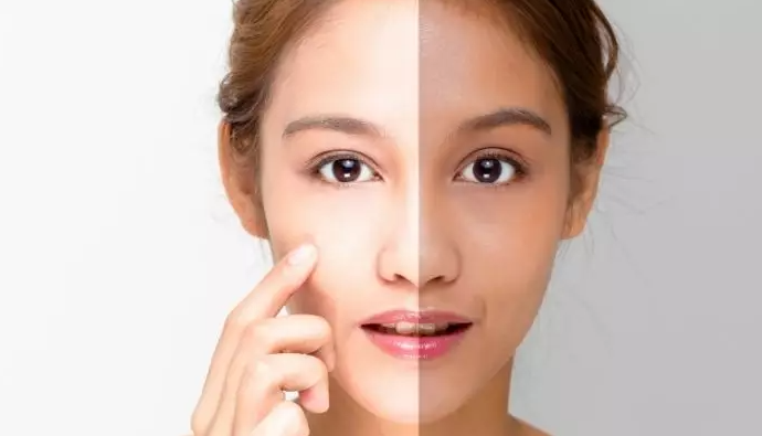 Skin Brightening Treatment Services episode artwork