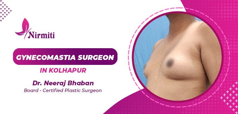 Gynecomastia Surgeon in Sangli episode artwork