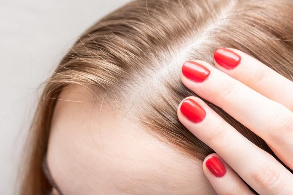 Hair Transplant Treatment episode artwork