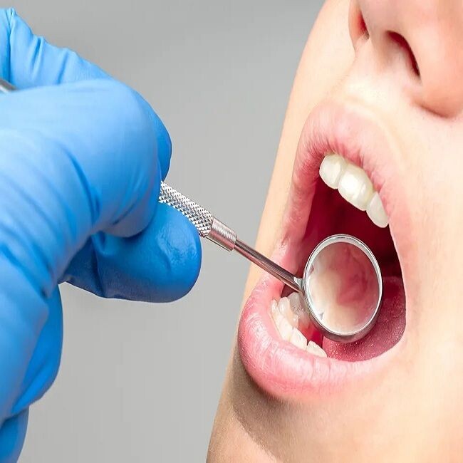 Dental Check Up Importance for Healthy Smiles episode artwork