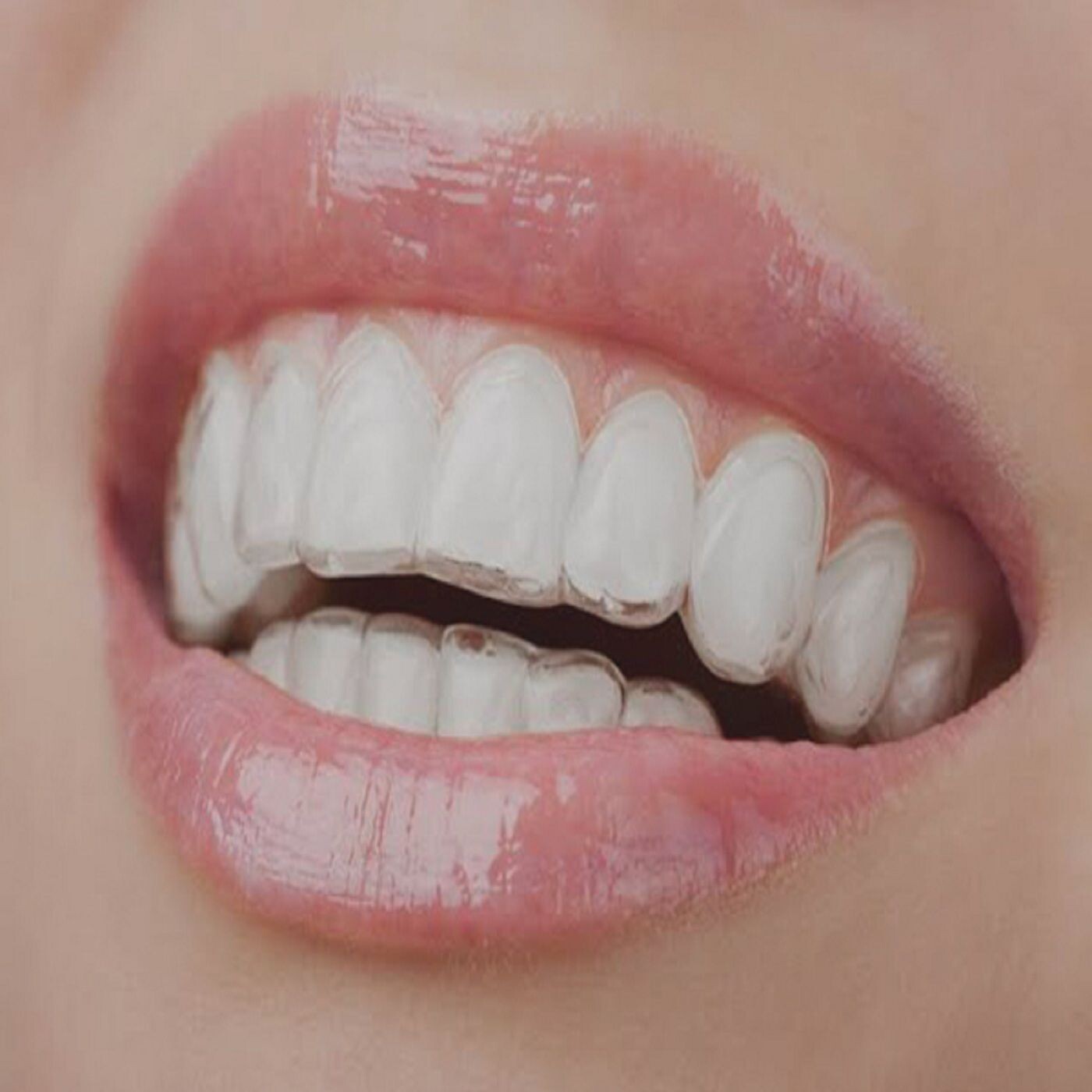 Straight Talk: Navigating Invisalign Options in Whyalla episode artwork