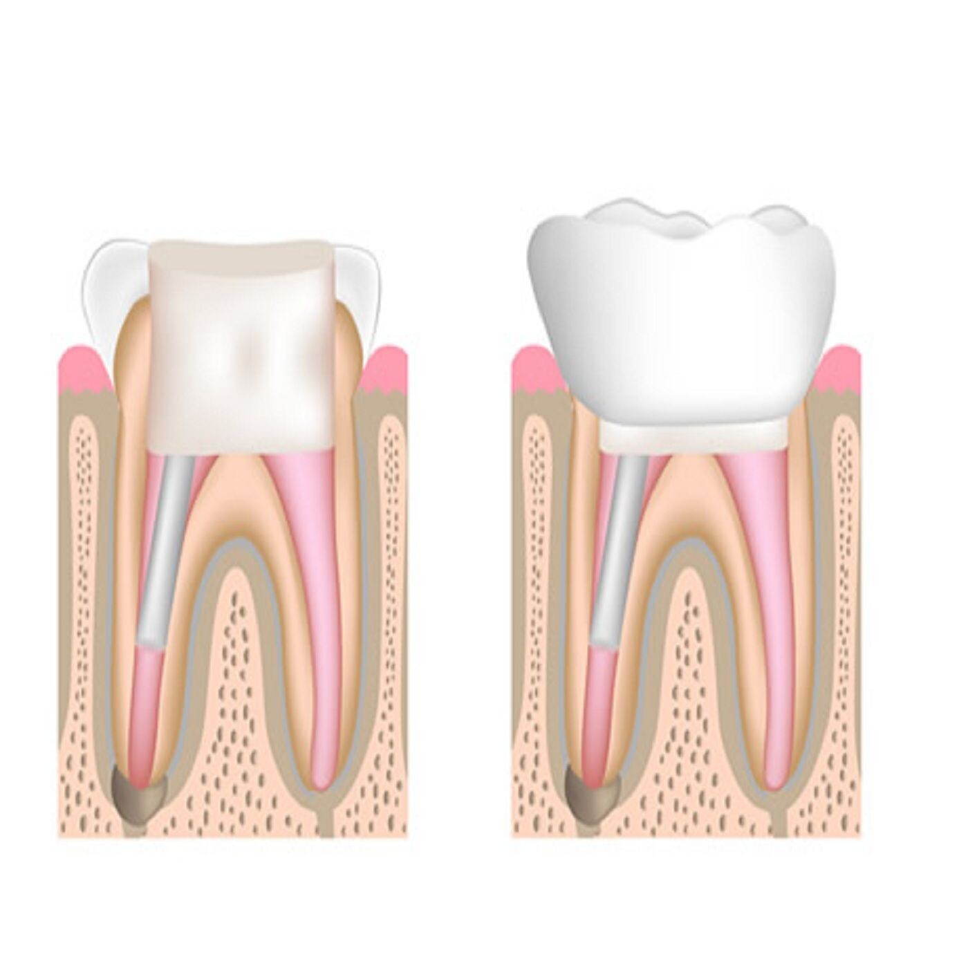 Root Canal Recovery: What to Expect and How to Heal Fast episode artwork