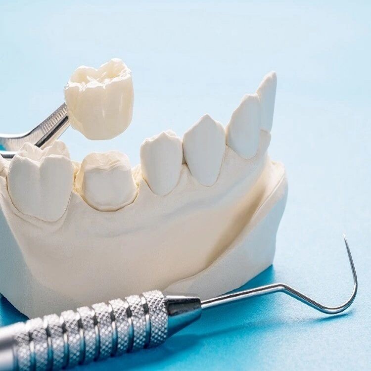 Everything You Need to Know About Dental Crowns: Benefits & Process episode artwork