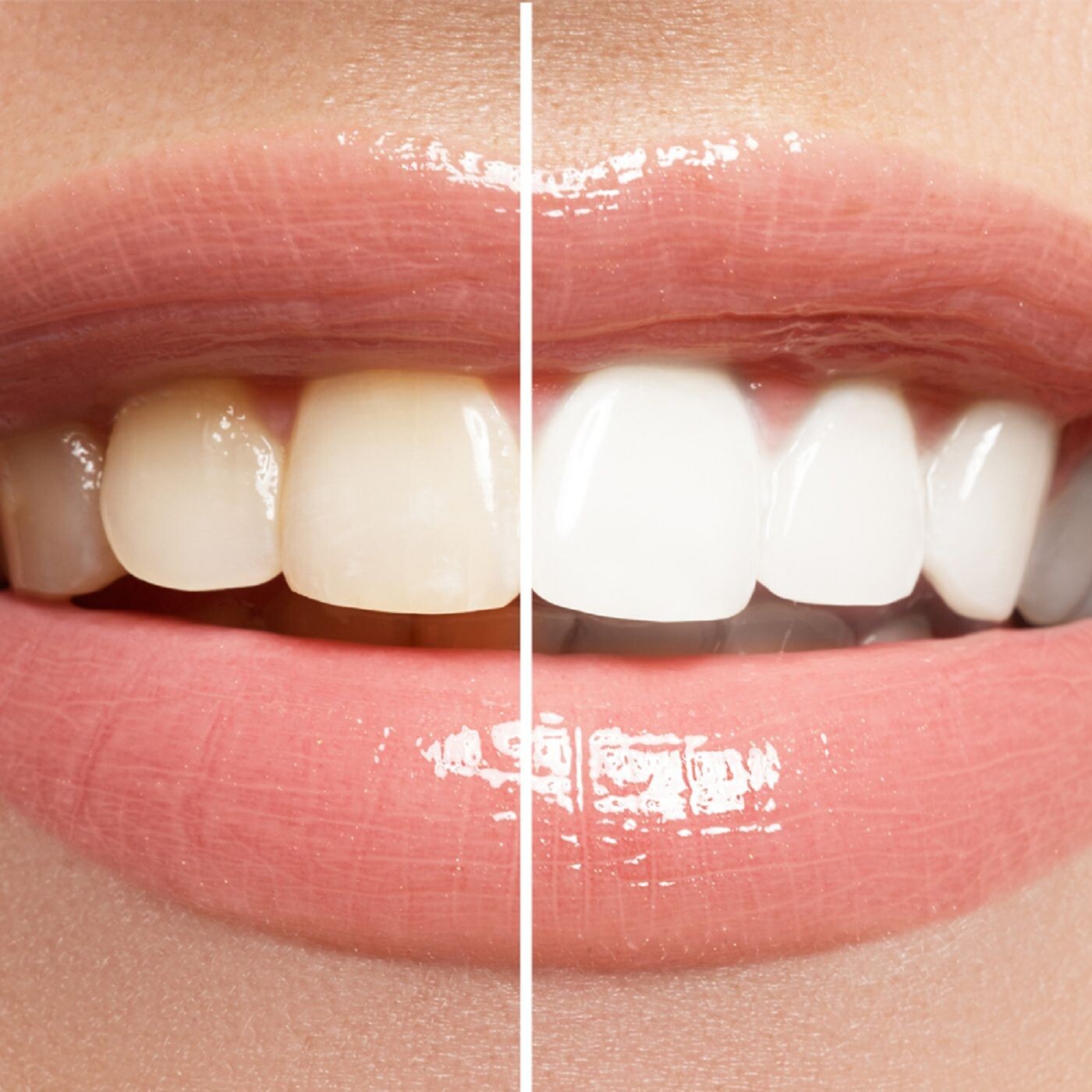 Teeth Whitening in Mitcham: Brighten Your Smile Today episode artwork