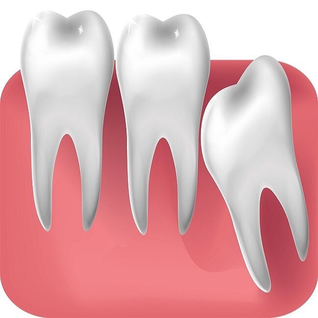Navigating Tooth Removal Costs: What You Should Know Before the Procedure episode artwork