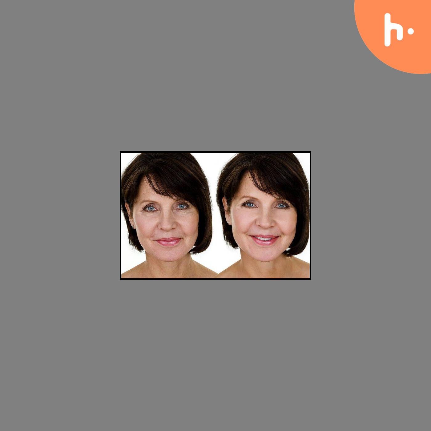 Unveiling a Youthful Glow: Chemical Peel Treatment at Lifestyle's MedSpa podcast artwork
