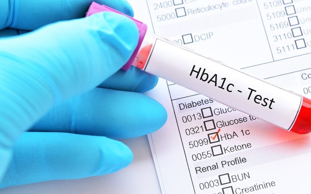 Best Blood Test Lab in Mohali: Trusted and Reliable Pathology Services