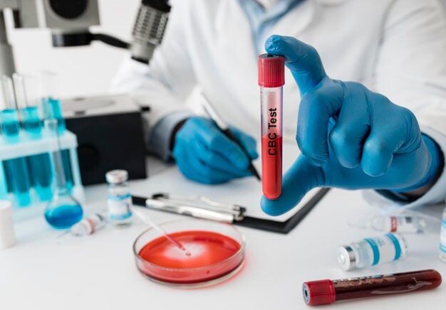 Understanding CBC Test Prices in Chandigarh: A Comprehensive Guide