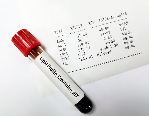 Low-Cost Lipid Profile Testing in Chandigarh: Top Recommendations