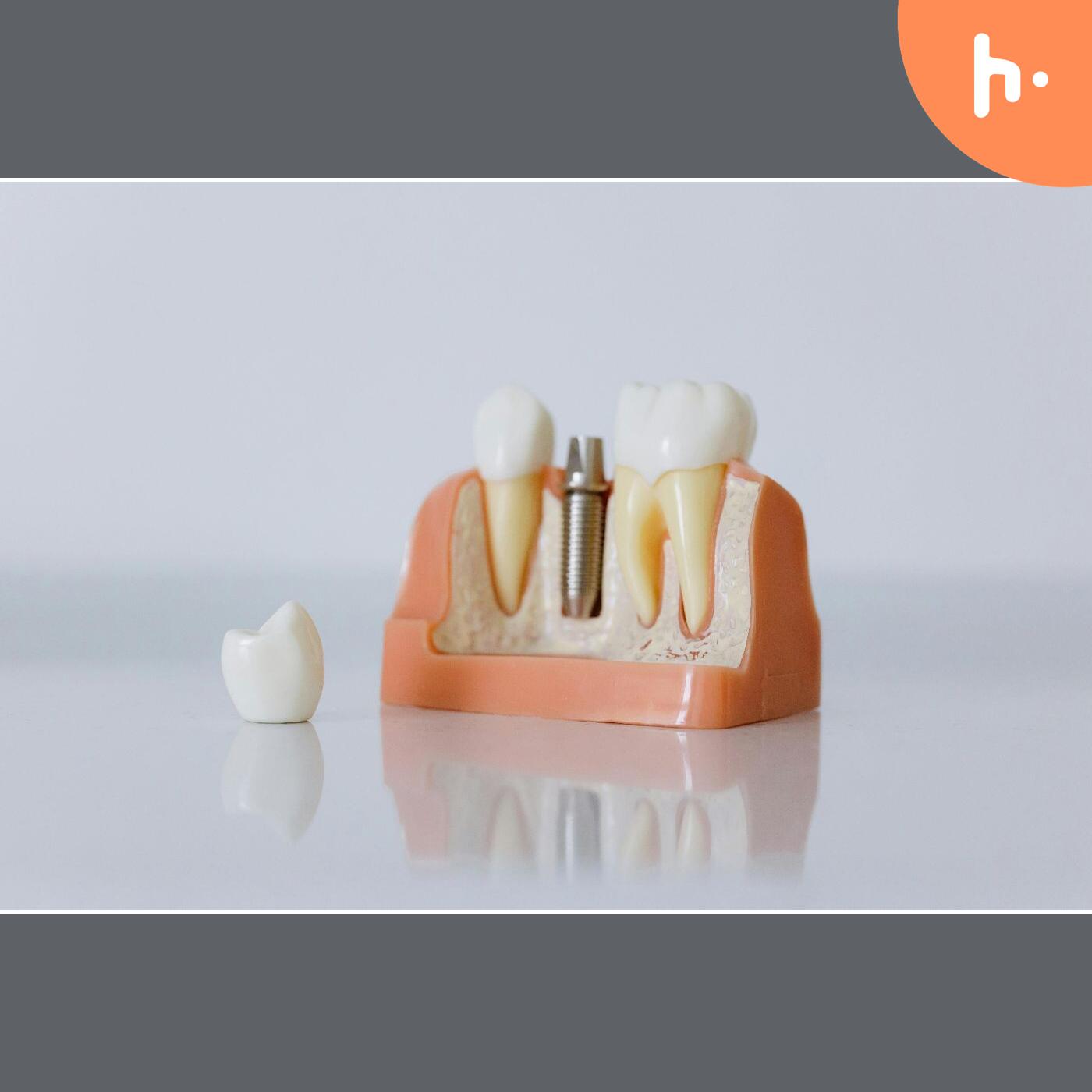 Exceptional Benefits of an Implant Dentist in Los Gatos podcast artwork