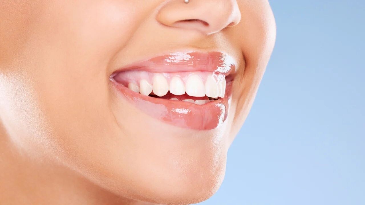 Teeth Whitening Dentist Cost in India: Everything You Need to Know episode artwork