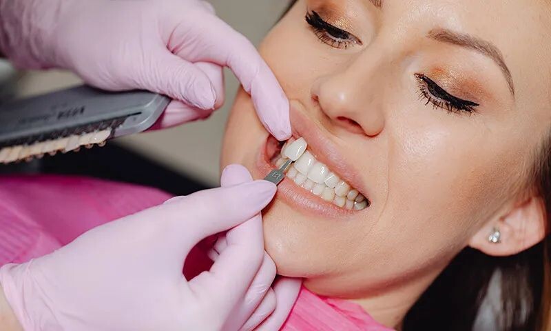 2 Front Teeth Veneers Cost: Everything You Need to Know episode artwork