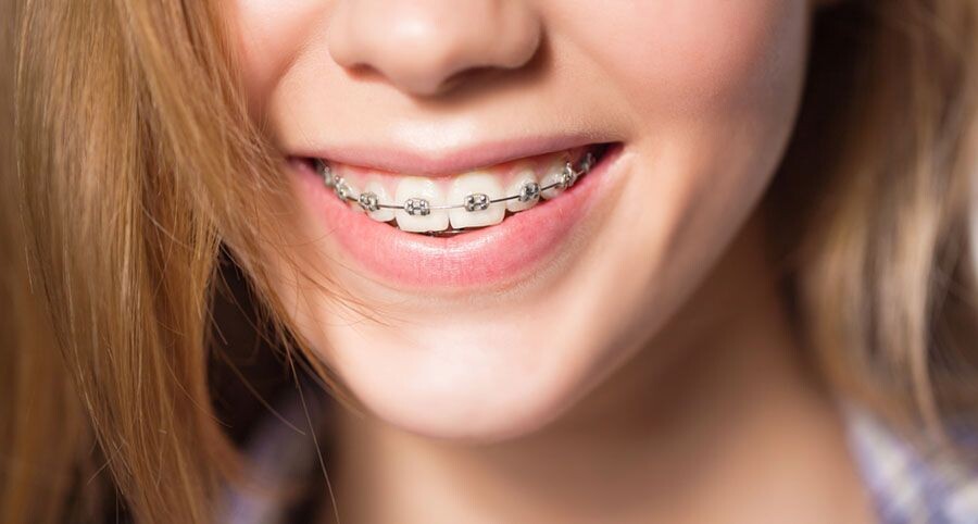 Top Orthodontist in Chandigarh: Your Guide to Dental Braces and Beyond episode artwork