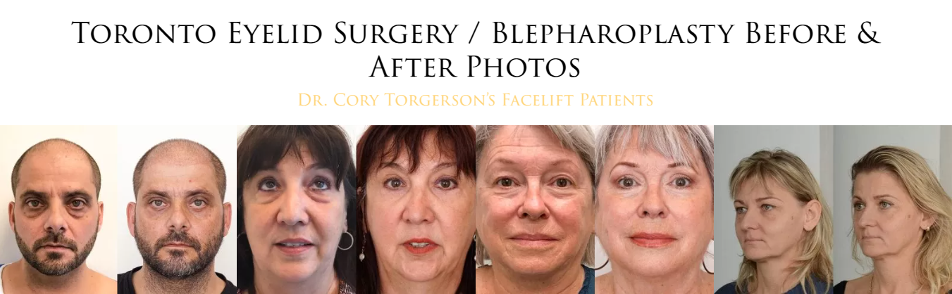 Bright Eyes, Confident You: Understanding Eyelid Surgery in Toronto episode artwork