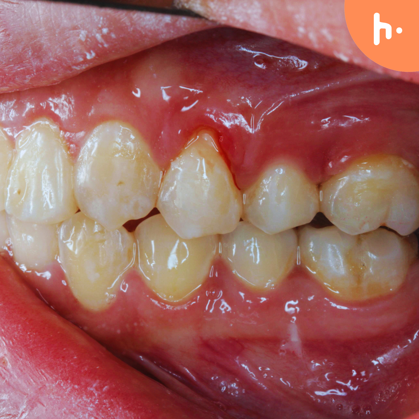 How Can Kellyville Dentist Help You Smile with Confidence? podcast artwork